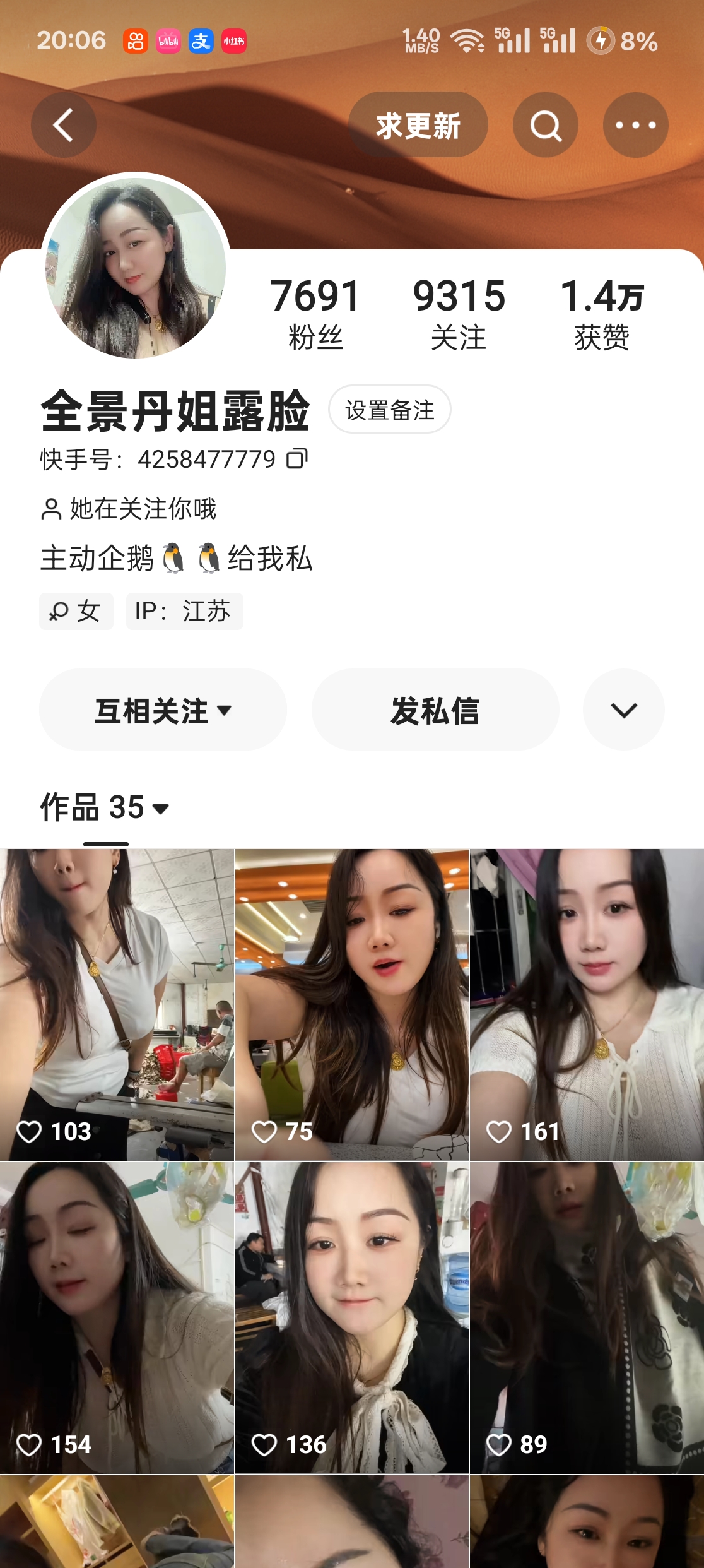 16042759354